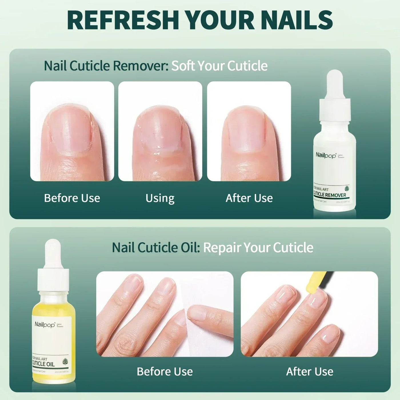 Cuticle Remover and Repair Oil Set – Nail Treatment & Dead Skin Remover by Nailpop